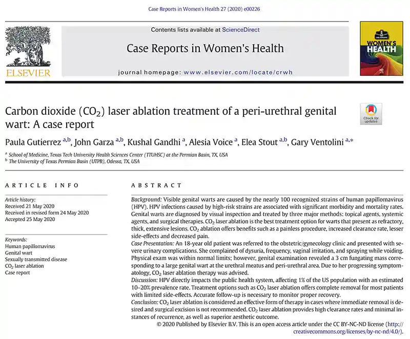 مطالعه کیس ریپورت در سال 2020 توسط Paula Gutierrez و همکاران درباره درمان زگیل تناسلی با لیزر در یک بیمار 18 ساله